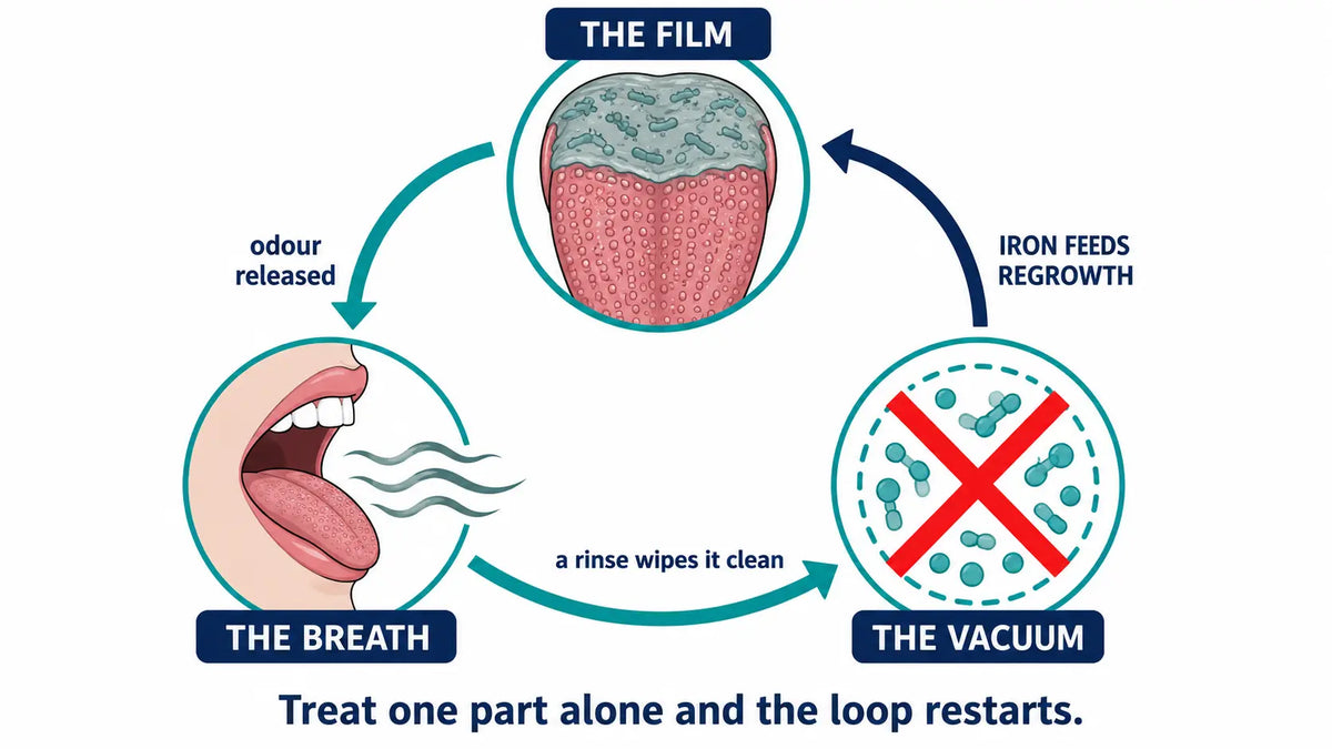 The back of the tongue — where the film that keeps regenerating the odour actually lives. Seeing it drawn out made twenty years of confusion make sense.